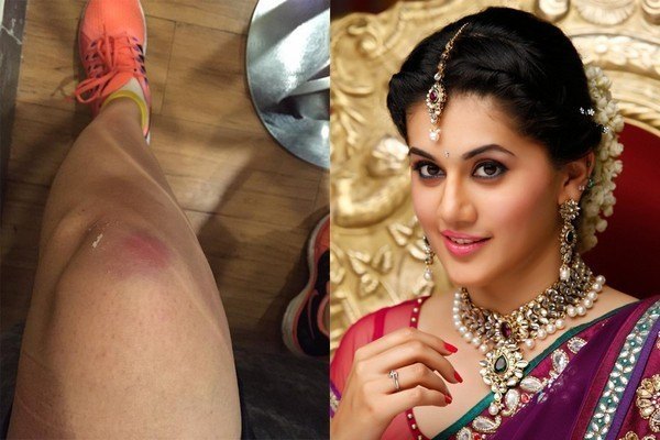 Spotted Scariest Leg Injury Picture Share by Actress Taapsee Pannu