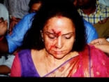 Hema Malini Car Accident Photos