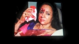 Hema Malini Car Accident Photos