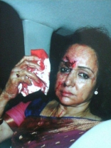 Hema Malini Car Accident Photos