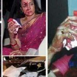 Hema Malini Car Accident Near Jaipur Photos